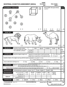 MoCA Form