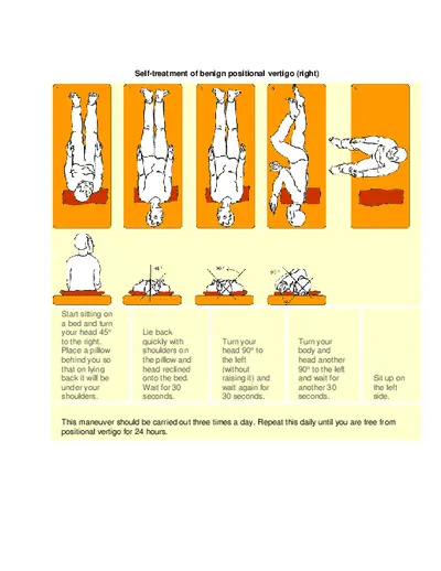 Home Epley Maneuver Instructions and Guidelines PDF