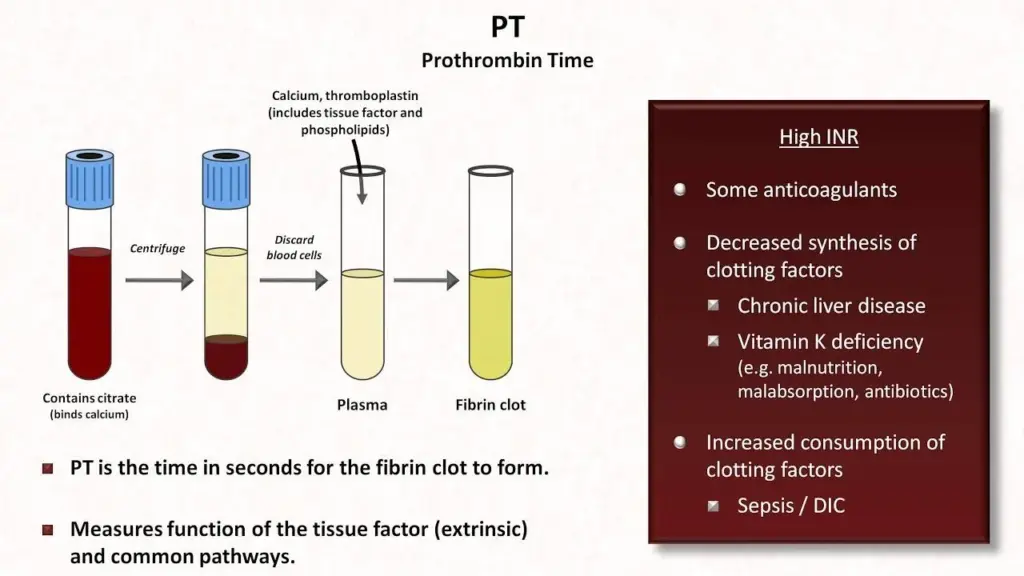Module 3: Hb, PCV, Coagulation Studies — Figure 26