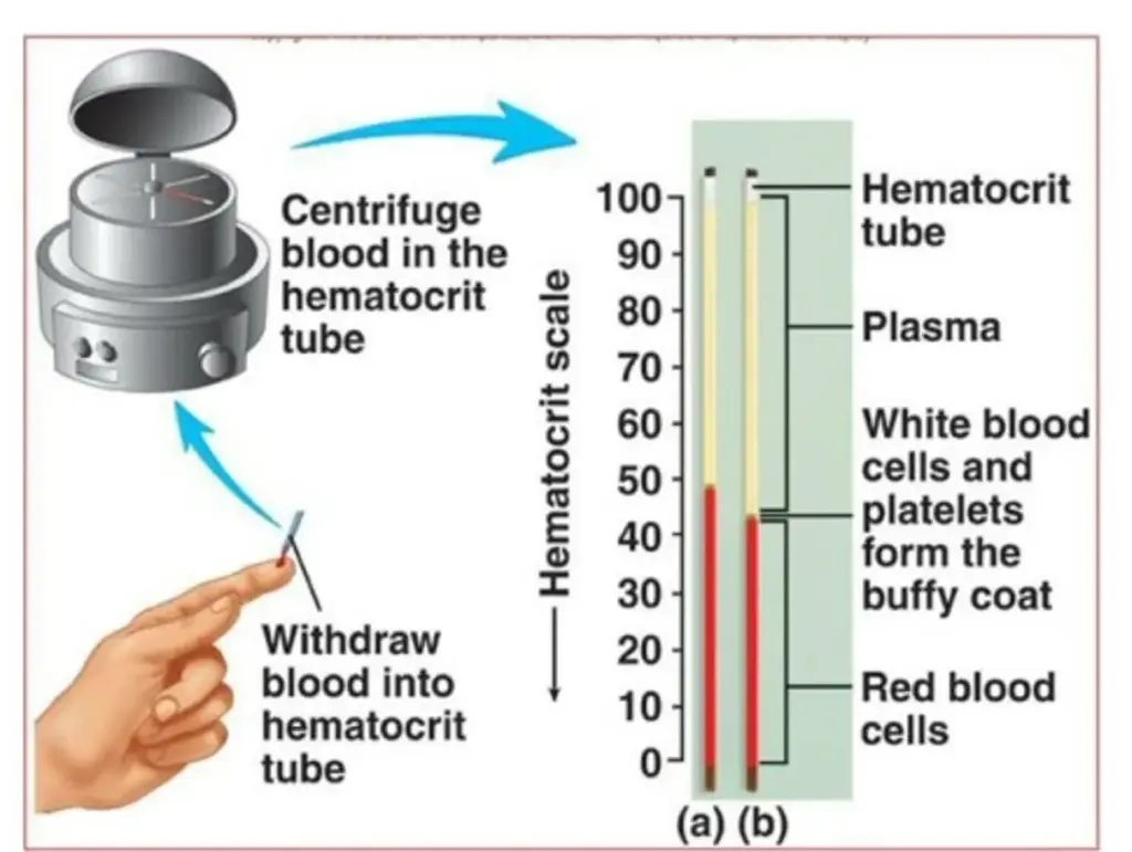 Diagram Showing The Method of P.C.V