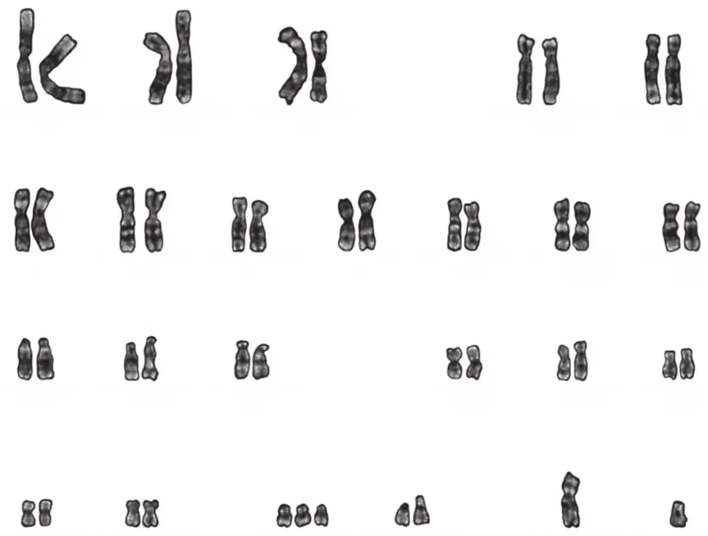 Which description matches an individual who has this karyotype?