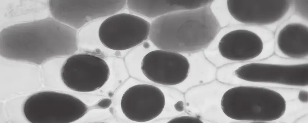 (a)  State three items of apparatus that you would need to use to observe the actual cells shown